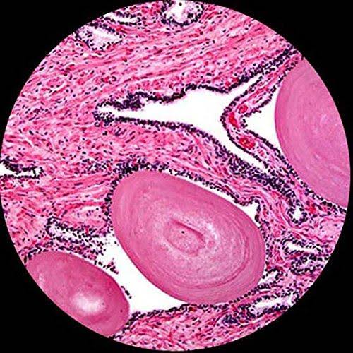 40X-2000X Binocular Microscope with 5MP Camera J15842